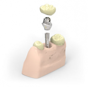 CAD software / design / 3-D / for dental applications - DentCAD