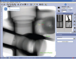 X-ray image visualization software - VISTAPLUS V